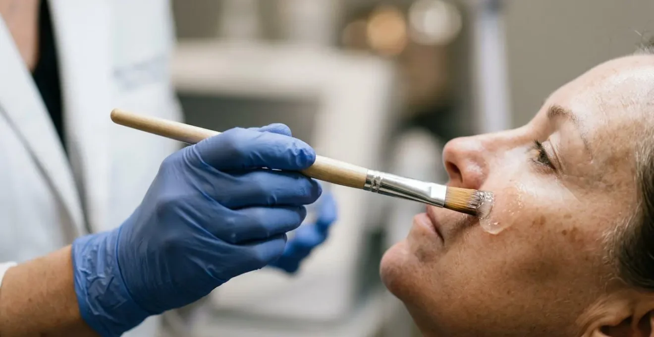 Trattamento peeling chimico per macchie solari sul viso con applicazione professionale