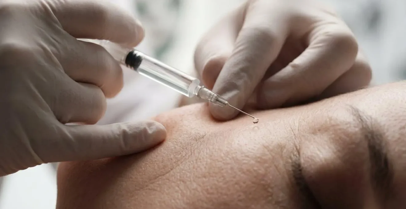 Tecnica di iniezione BAP con 5 punti strategici per biorivitalizzazione del viso